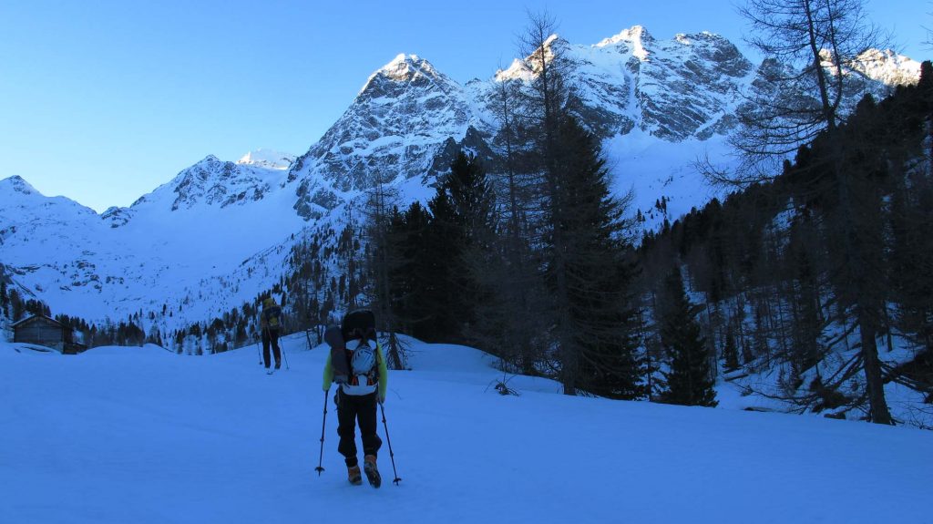 Hydrocephalus © Ulrich Viertler und Rafaele Sebastiani & Alexander Mayer