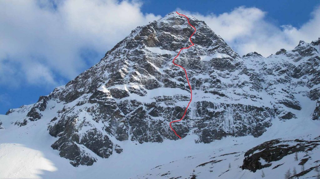 Hydrocephalus © Ulrich Viertler und Rafaele Sebastiani & Alexander Mayer